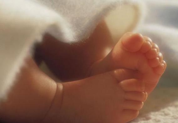 Ditinggal Tidur di Ayunan, Bayi Lima Bulan Diduga Tersiram Air Mendidih